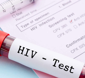 HIV Test Kit