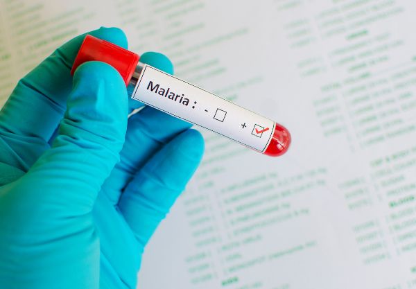 Malaria-Symptoms