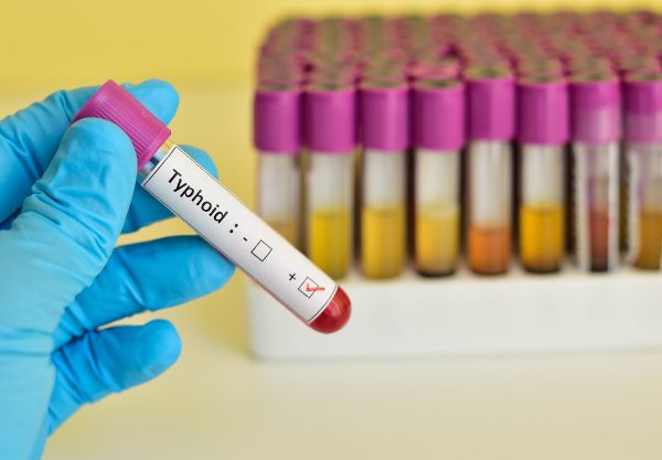 Typhoid-Test-Kit-Types