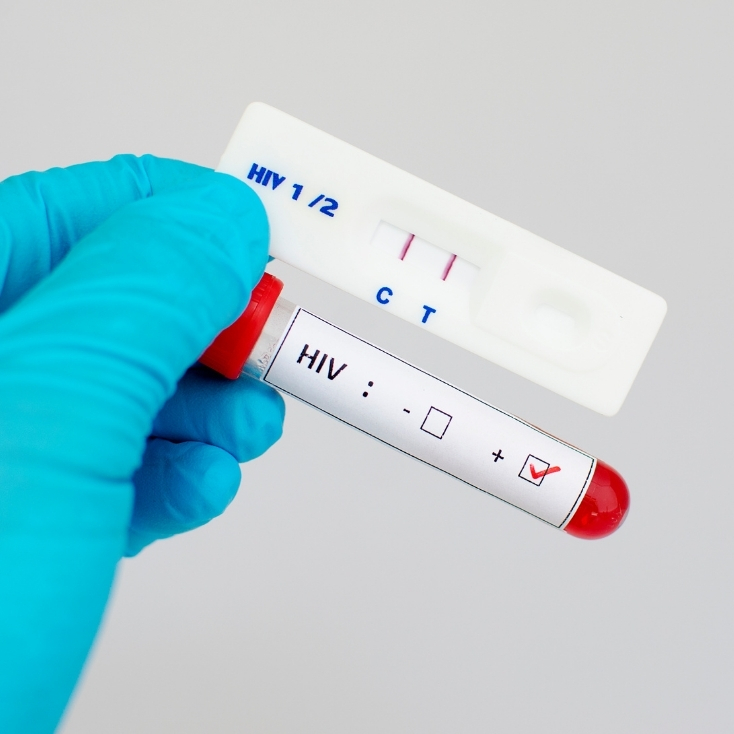 Chlamydia Rapid Test