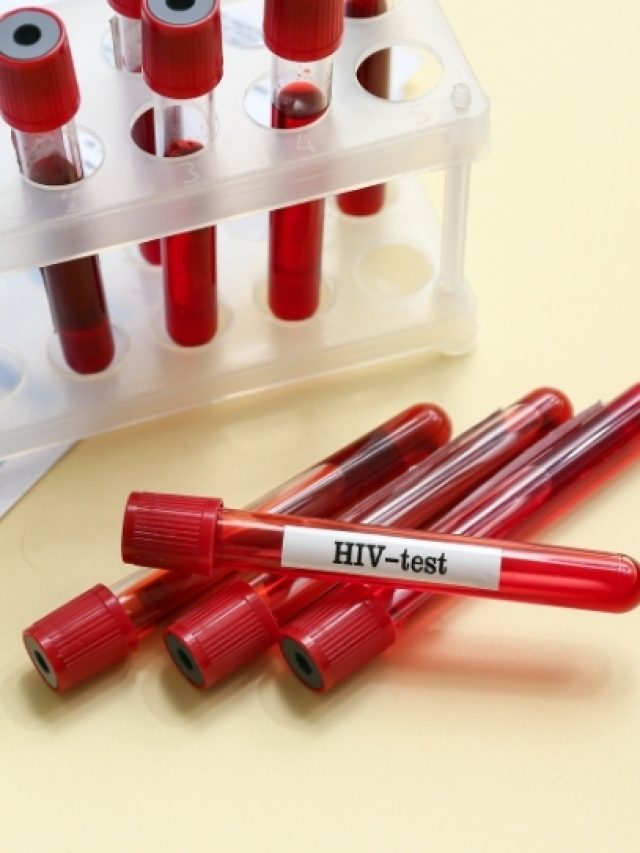 Non-Invasive Sample Collection