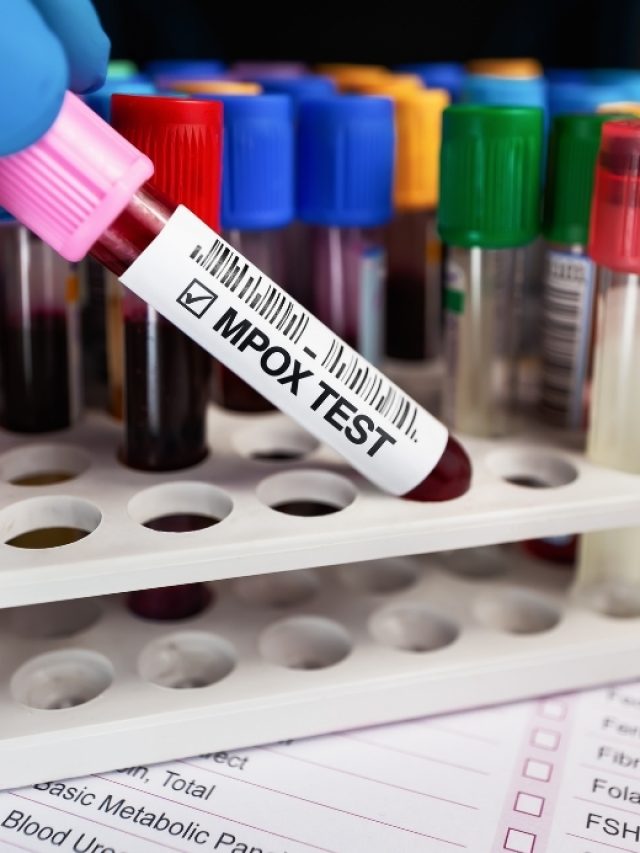 iCARE Monkeypox Antigen Rapid Test Kit