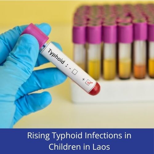Typhoid Test Kits