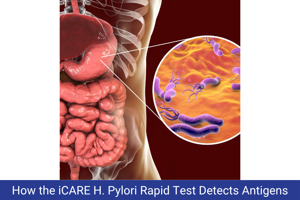  H. Pylori Stool Antigen Test