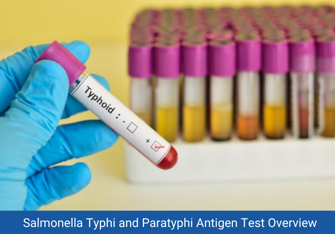 Salmonella Typhi and Paratyphi Antigen Test